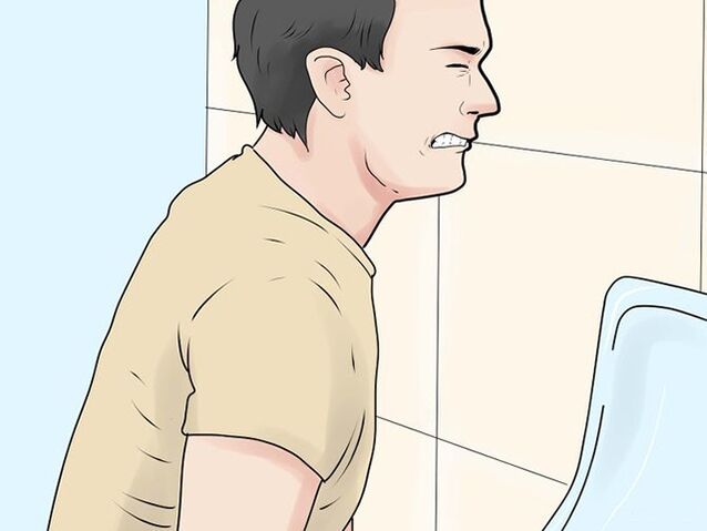 douleur en urinant à cause d'une prostatite